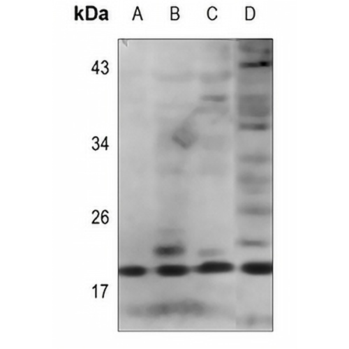 IL-2 Rabbit Polyclonal Antibody