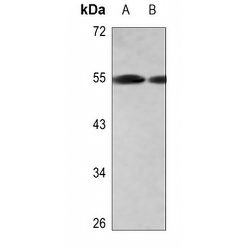 CD181 Rabbit Polyclonal Antibody