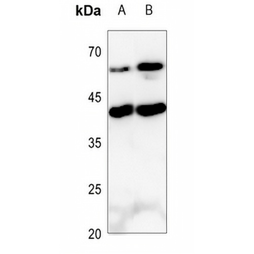 IL-9 Rabbit Polyclonal Antibody