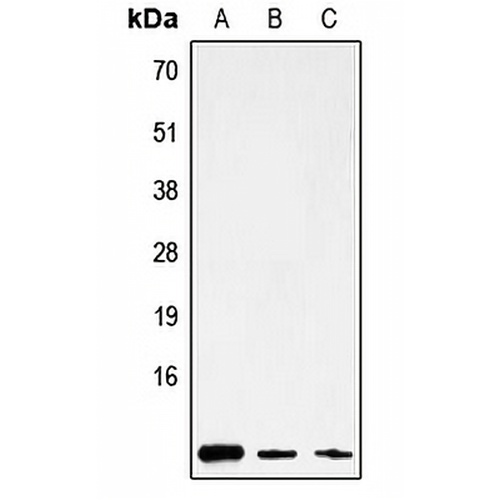 ATP8 Rabbit Polyclonal Antibody