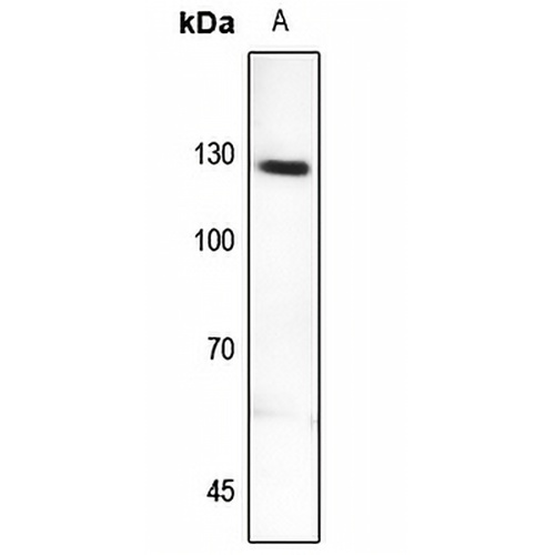 MYBPC2 Rabbit Polyclonal Antibody