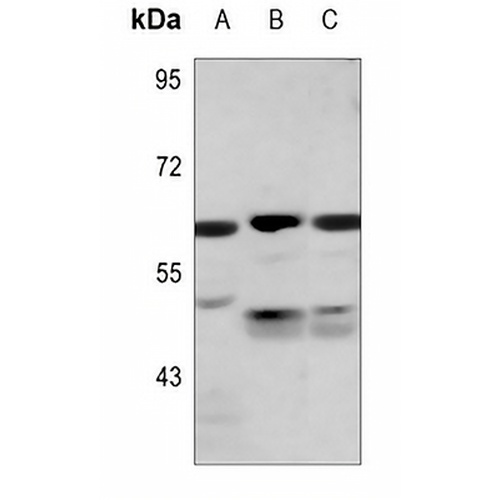 PKLR Rabbit Polyclonal Antibody