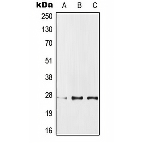 IPP1 Rabbit Polyclonal Antibody