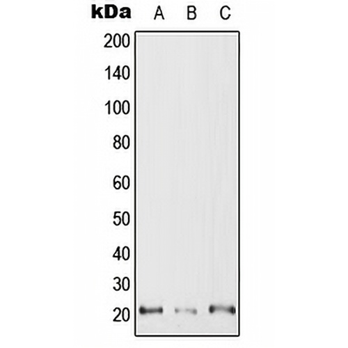 RAC2 Rabbit Polyclonal Antibody