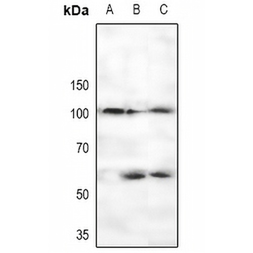 CTIP (Phospho-S327) Rabbit Polyclonal Antibody
