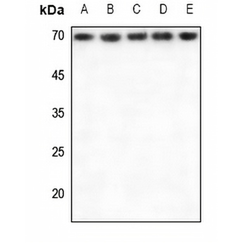 RPA1 Rabbit Polyclonal Antibody
