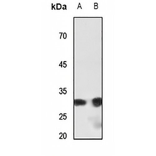 SHOX Rabbit Polyclonal Antibody