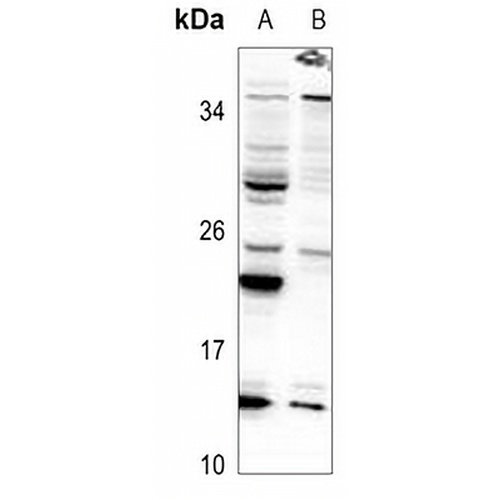 SNRPD3 Rabbit Polyclonal Antibody