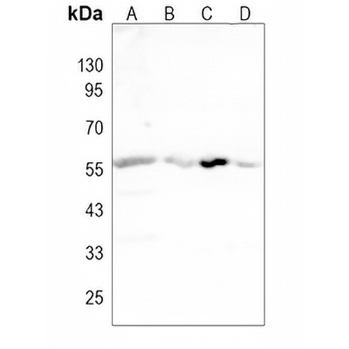 SSTR2 Rabbit Polyclonal Antibody