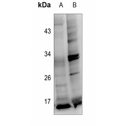 Protachykinin 1 Rabbit Polyclonal Antibody