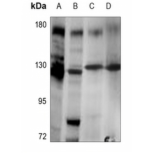 Telomerase Rabbit Polyclonal Antibody