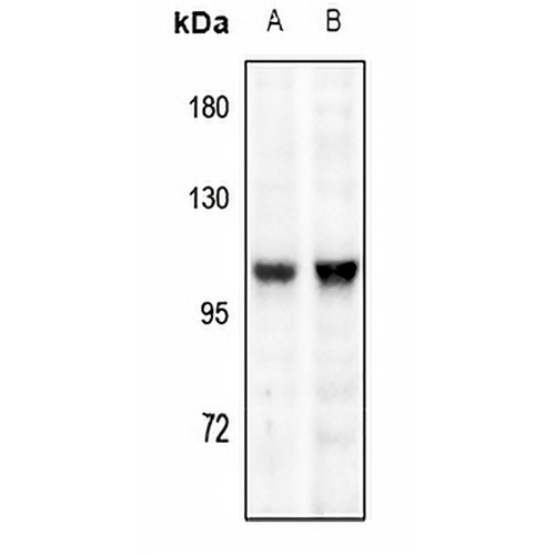 TRPV1 Rabbit Polyclonal Antibody