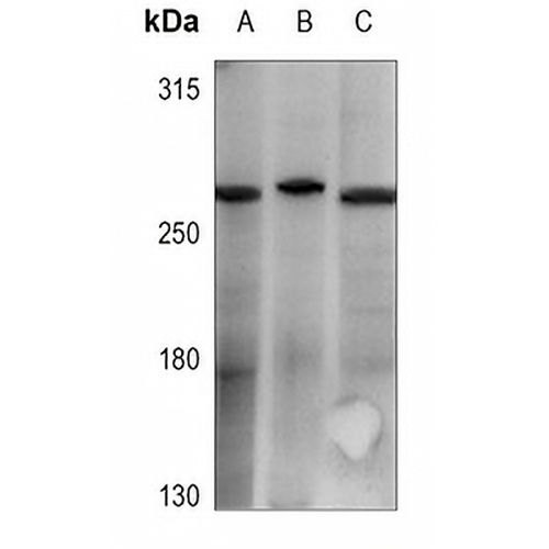 Cav3.1 Rabbit Polyclonal Antibody