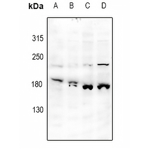 JIP4 Rabbit Polyclonal Antibody