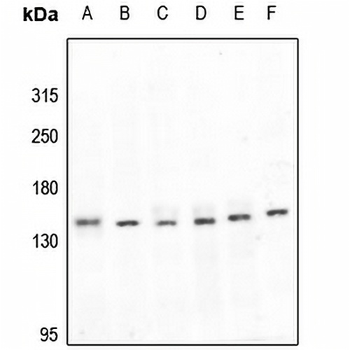 LATS1 Rabbit Polyclonal Antibody