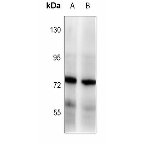 BAG3 Rabbit Polyclonal Antibody