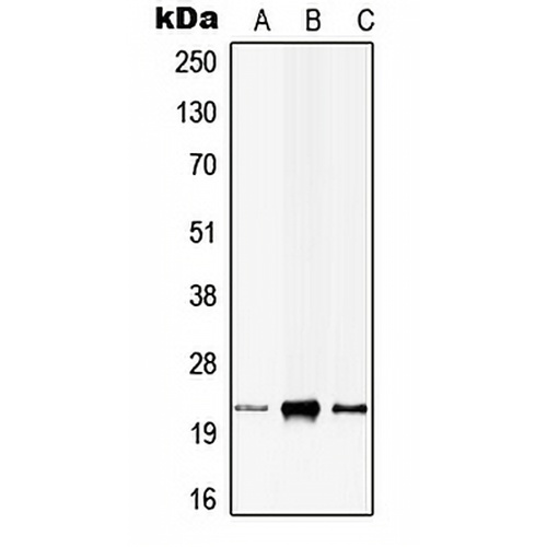 CIB1 Rabbit Polyclonal Antibody