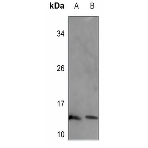 SEC61B Rabbit Polyclonal Antibody