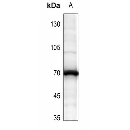 ATE1 Rabbit Polyclonal Antibody