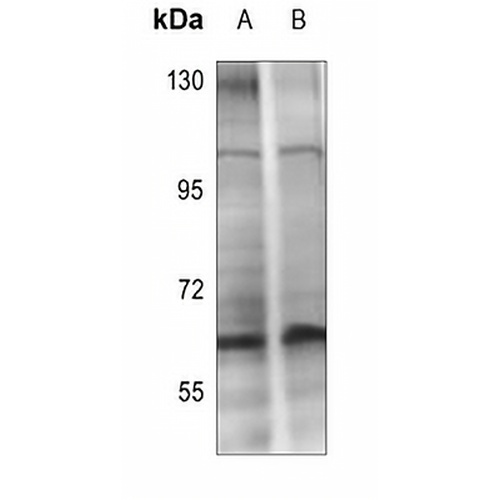 CHK2 (Phospho-T432) Rabbit Polyclonal Antibody