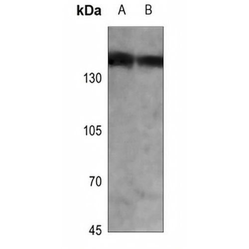 PHLPP Rabbit Polyclonal Antibody