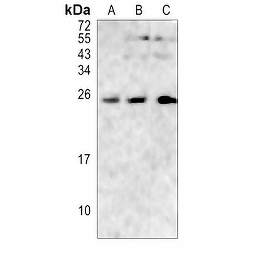 RGS17 Rabbit Polyclonal Antibody