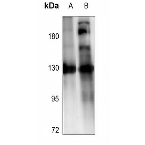 ZO3 Rabbit Polyclonal Antibody
