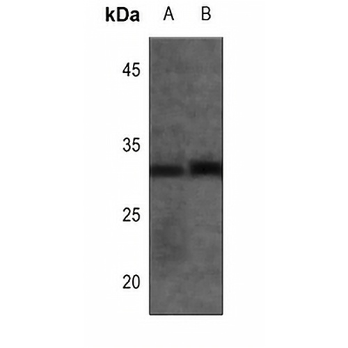 CALY Rabbit Polyclonal Antibody
