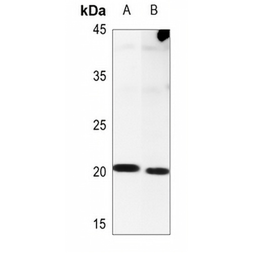 NIP7 Rabbit Polyclonal Antibody
