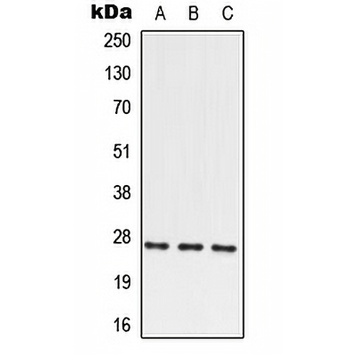 PRRX2 Rabbit Polyclonal Antibody