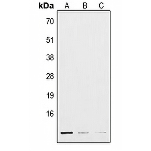 POLR3K Rabbit Polyclonal Antibody
