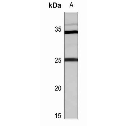 RAB39A Rabbit Polyclonal Antibody
