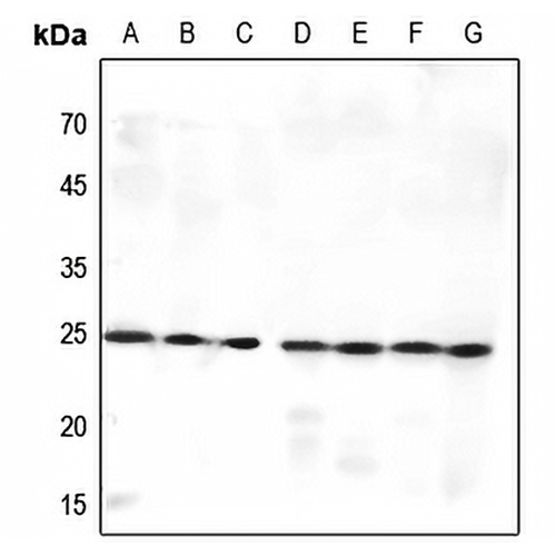 MED9 Rabbit Polyclonal Antibody