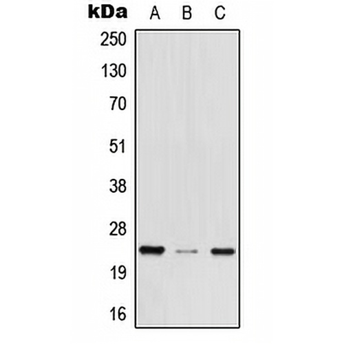 MED29 Rabbit Polyclonal Antibody