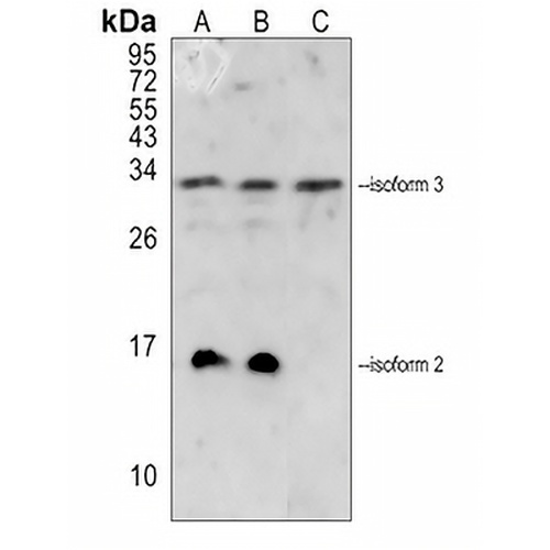 MOB2 Rabbit Polyclonal Antibody