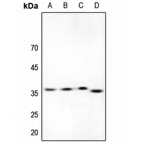 ACER1 Rabbit Polyclonal Antibody