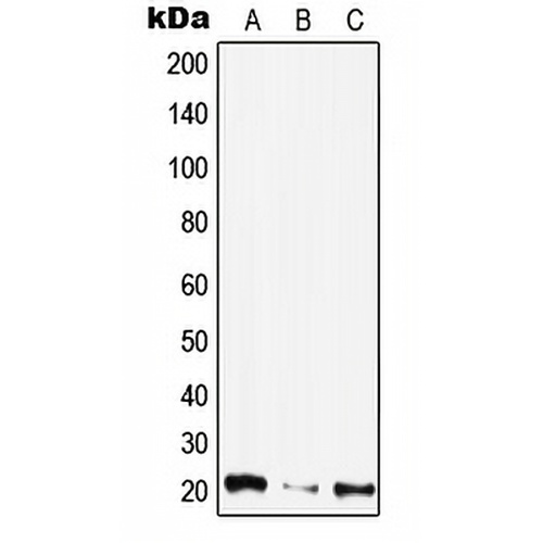 CIB4 Rabbit Polyclonal Antibody