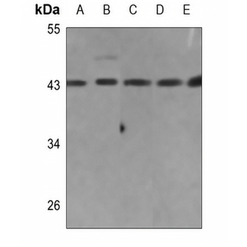 Collagen 26 alpha 1 Rabbit Polyclonal Antibody