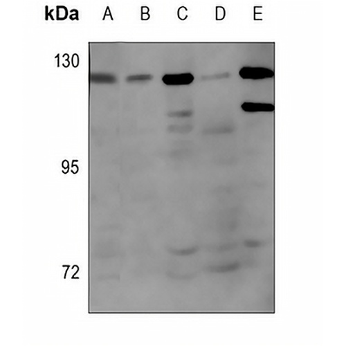Androgen Receptor (Phospho-S650) Rabbit Polyclonal Antibody