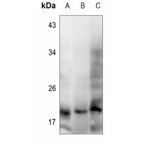 IFN alpha 1 Rabbit Polyclonal Antibody