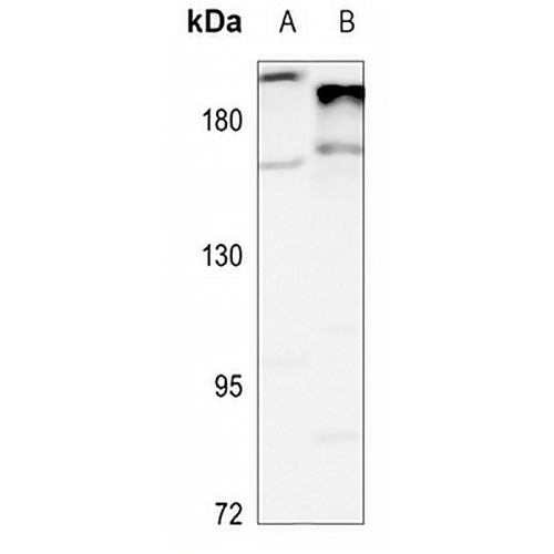 Complement C4A/B Rabbit Polyclonal Antibody