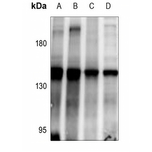 ABL1 Rabbit Polyclonal Antibody