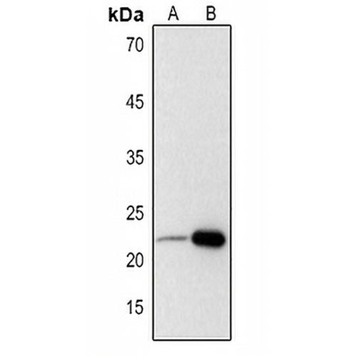 Adrenomedullin Rabbit Polyclonal Antibody
