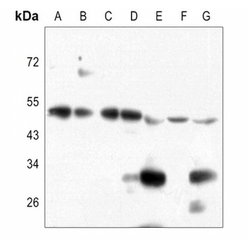 Alpha-2C Adrenergic Receptor Rabbit Polyclonal Antibody