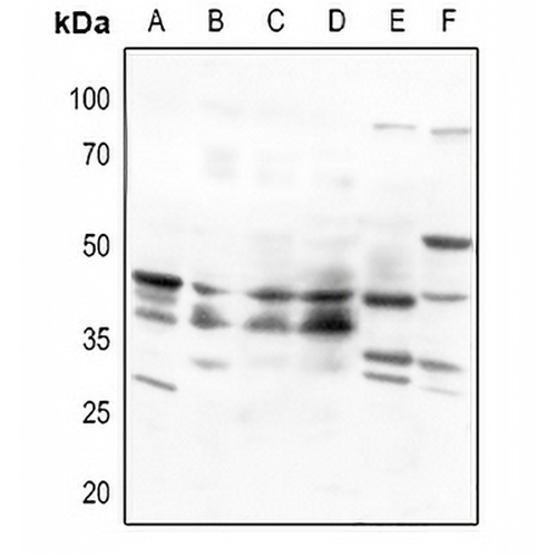 Beta-3 Adrenergic Receptor Rabbit Polyclonal Antibody