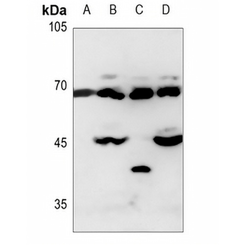 Alpha-fetoglobulin Rabbit Polyclonal Antibody