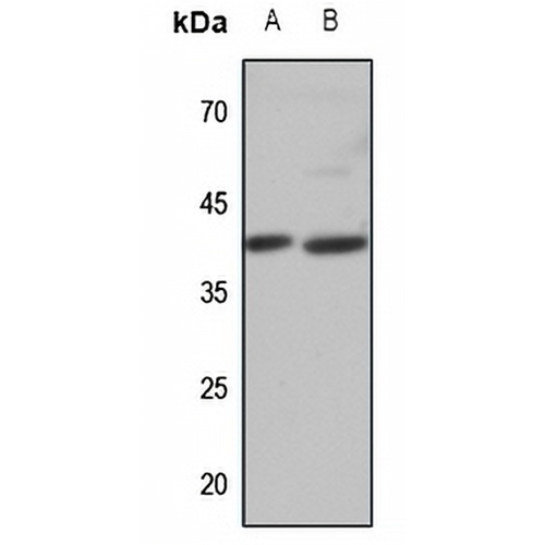APJ Rabbit Polyclonal Antibody