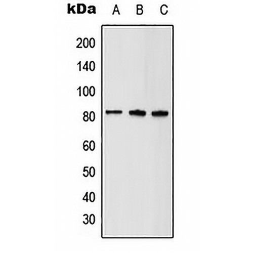 ABCD1 Rabbit Polyclonal Antibody