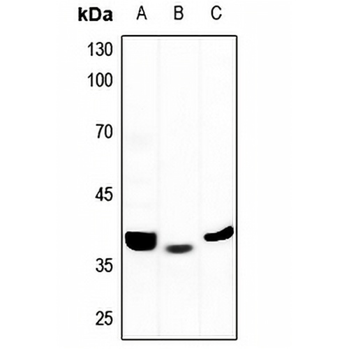 ALDOB Rabbit Polyclonal Antibody