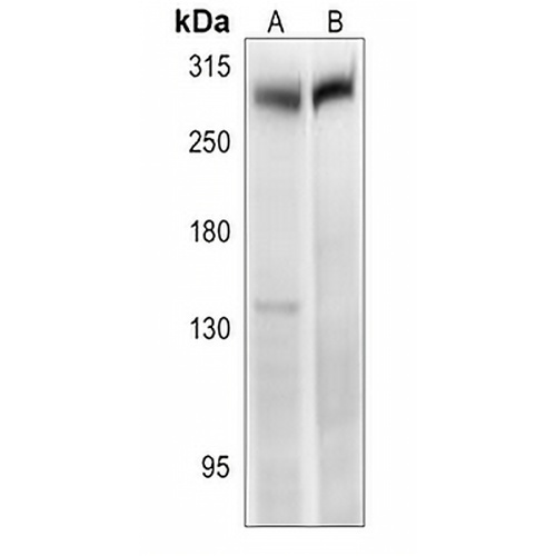 CD246 Rabbit Polyclonal Antibody